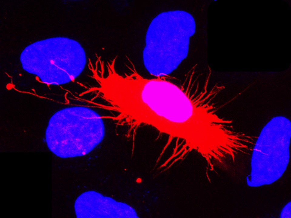 Confocal micrograph of astrocytoma cells transfected with mCherry LifeAct7, labeling the actin cytoskeleton